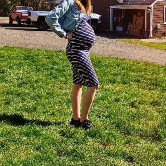 Striped Maternity Dress Bundle - Picture 6 of 7